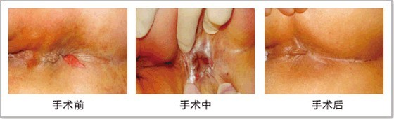 手术前后对比.jpg