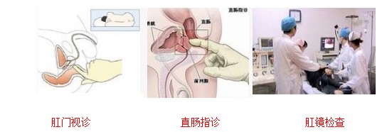 检查.jpg