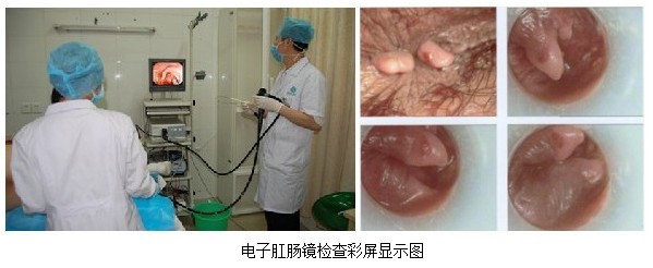 电子肛门镜彩屏显示.jpg