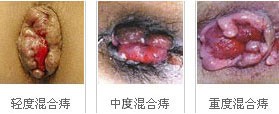 点击咨询