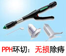 PPH痔上粘膜环切术