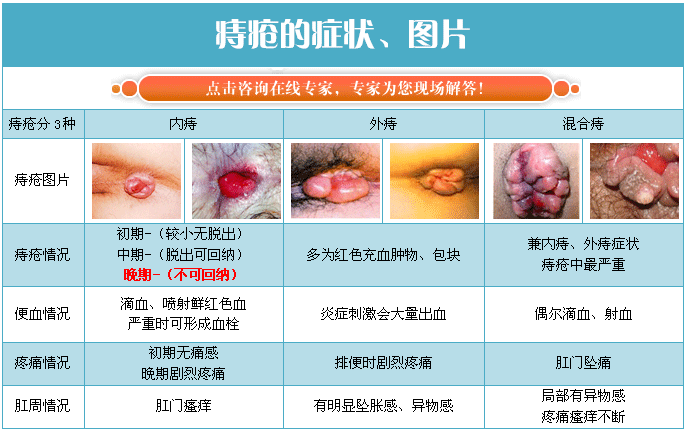 不是很明白？点击问问医生