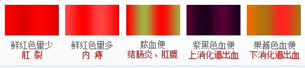 大便出血是什么原因？点击快速咨询